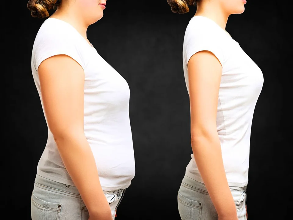 semaglutide weight loss before after photos La Nouvelle Medical Spa, Oxnard, Ventura county  