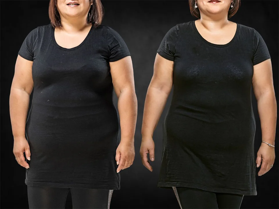 semaglutide weight loss before after photos La Nouvelle Medical Spa, Oxnard, Ventura county  