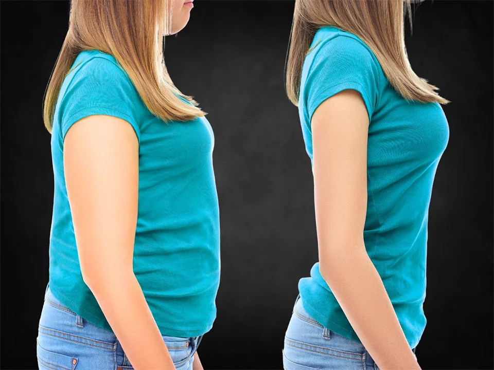 semaglutide weight loss before after photos La Nouvelle Medical Spa, Oxnard, Ventura county  