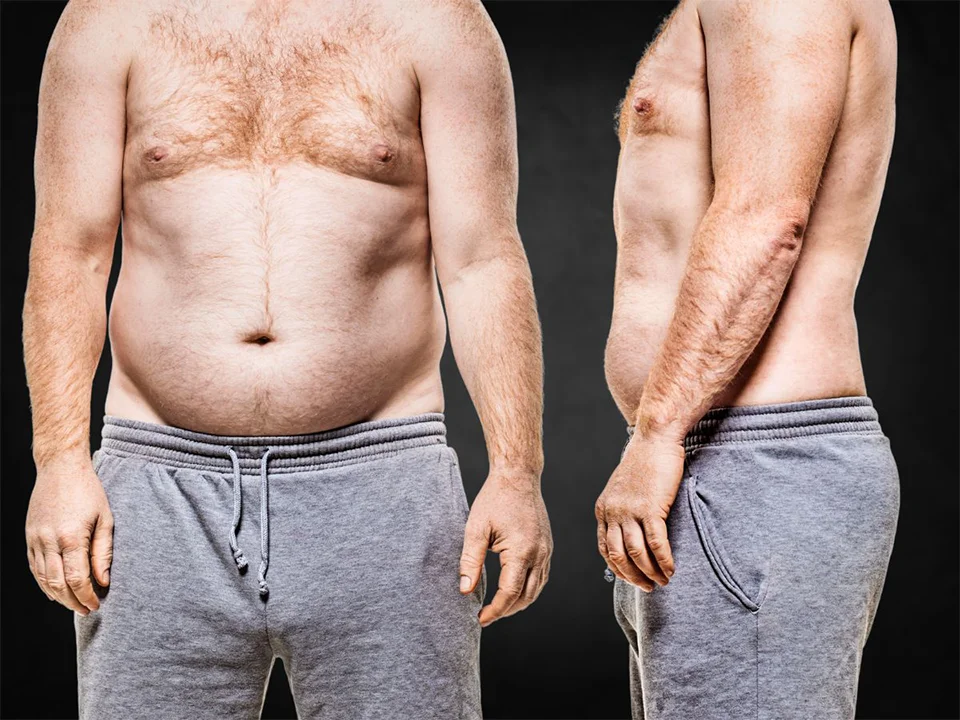 semaglutide weight loss before after photos La Nouvelle Medical Spa, Oxnard, Ventura county  