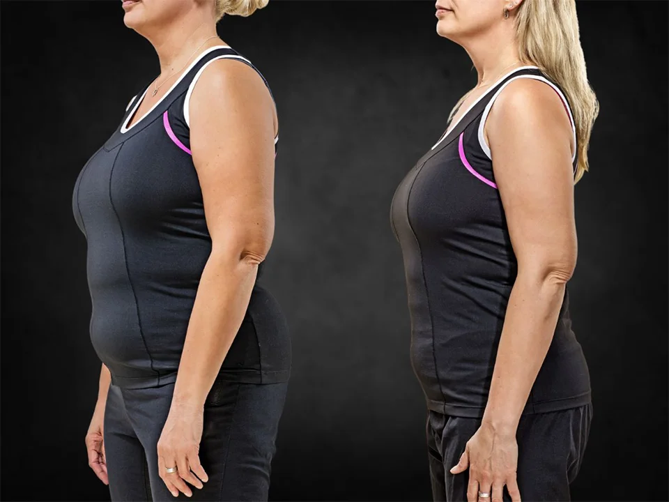 semaglutide weight loss before after photos La Nouvelle Medical Spa, Oxnard, Ventura county  